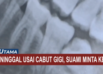 Viral di Medsos, Suami di Ngawi Minta Keadilan karena Istri Meninggal Usai Cabut Gigi