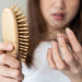 Cara Mengatasi Rambut Rontok Akibat Stress