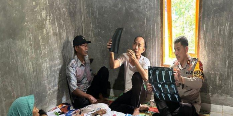 Rok Nyangkut di Jari-jari Motor, Wardatun Guru PPPK SD di Muba Kecelakaan, Tulang Engsel Bergeser