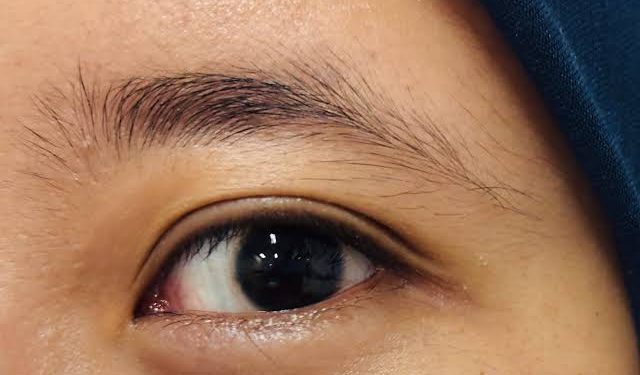 5 Gejala Gangguan Mata yang Harus Segera Diperiksa Dokter Spesialis